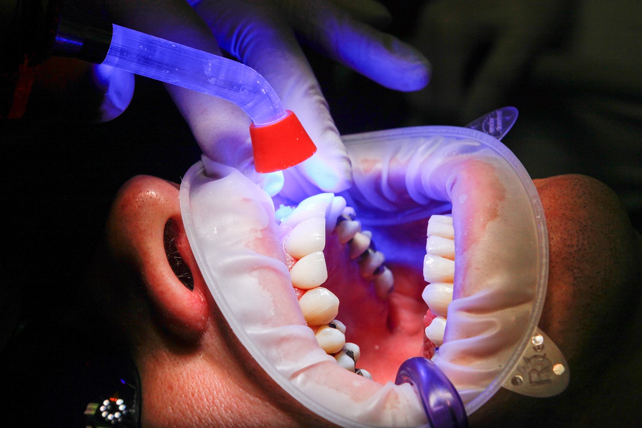 Najczęstsze mity o stomatologii – co powinniśmy wiedzieć?