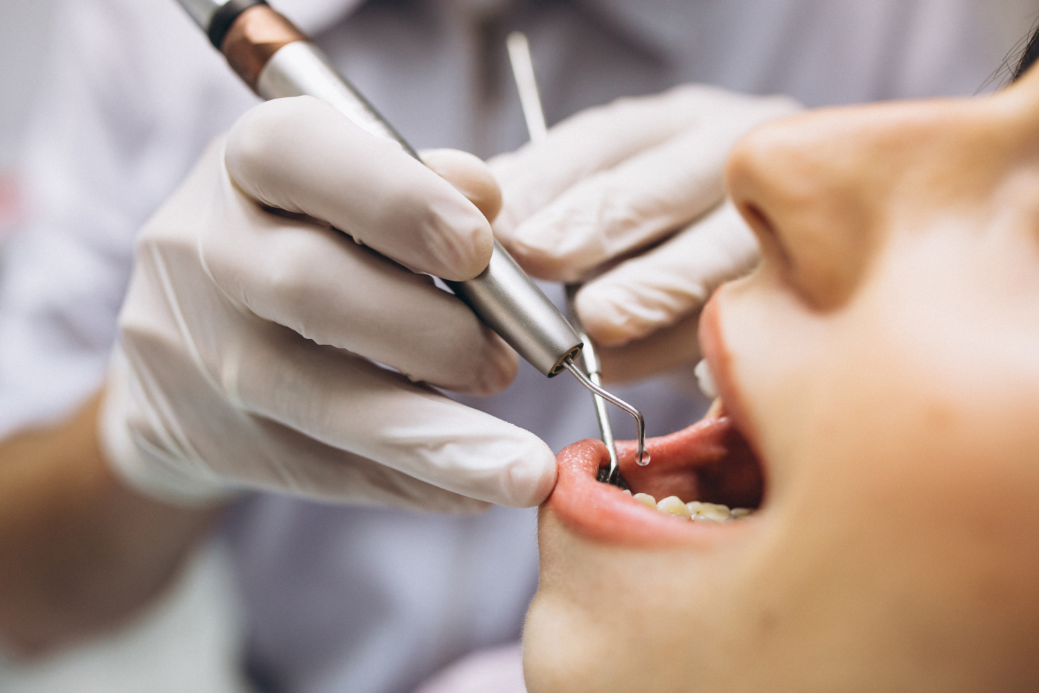leczenie periodontogiczne w katowicach